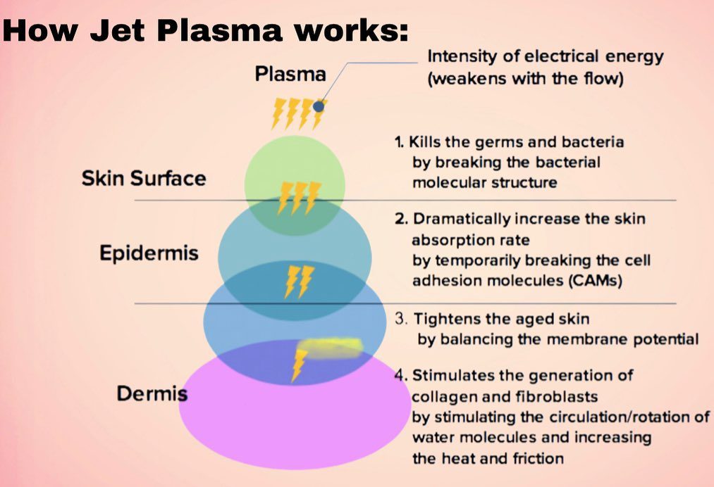 nj-jet-plasma